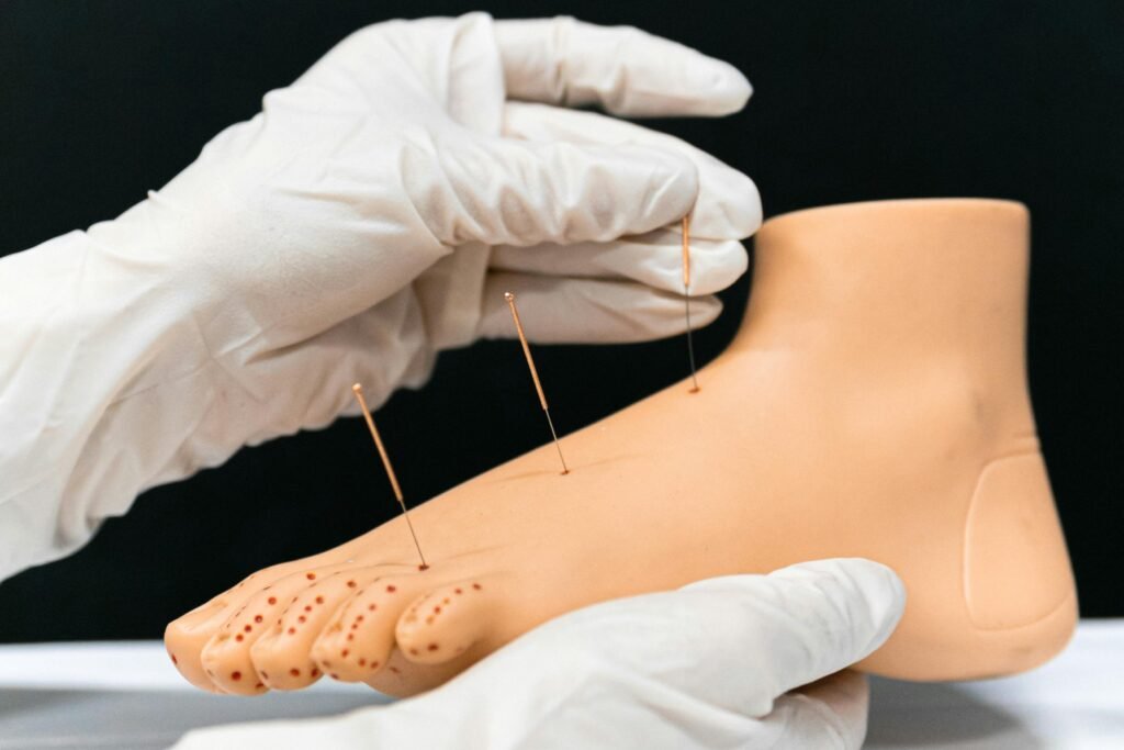 Acupuncture-In-Bpd Ayurveda, Rajendra Nagar, Ghaziabad